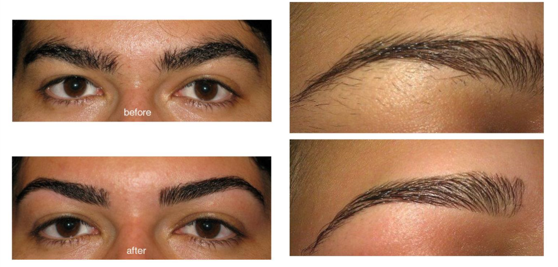 before and after threading image